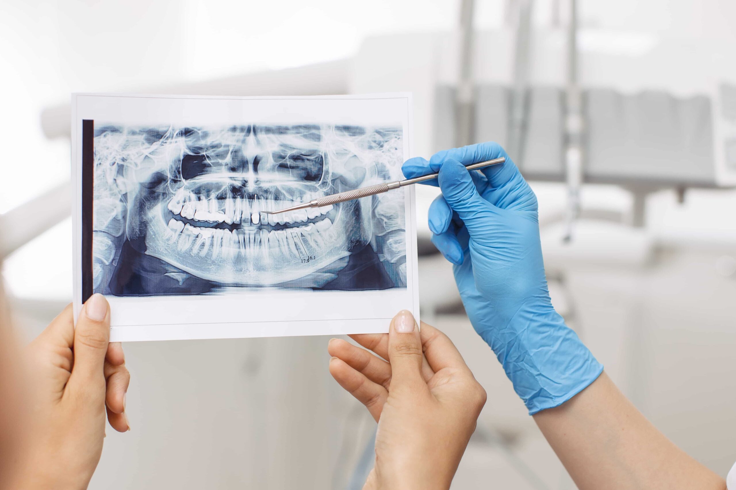 Röntgenbild Zahnarzt Litschau
